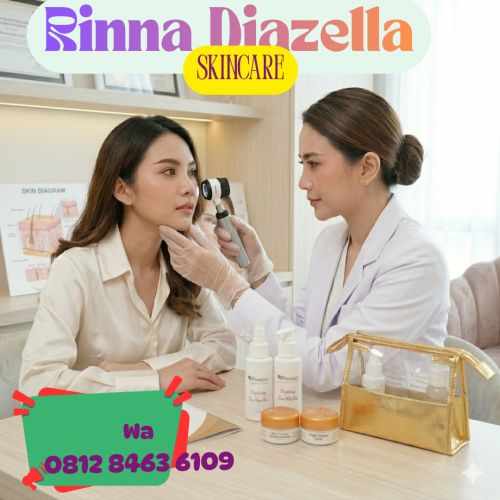 Paket cream rd rinna diazella Untuk Bekas jerawat- O8I2 8463 6IO9