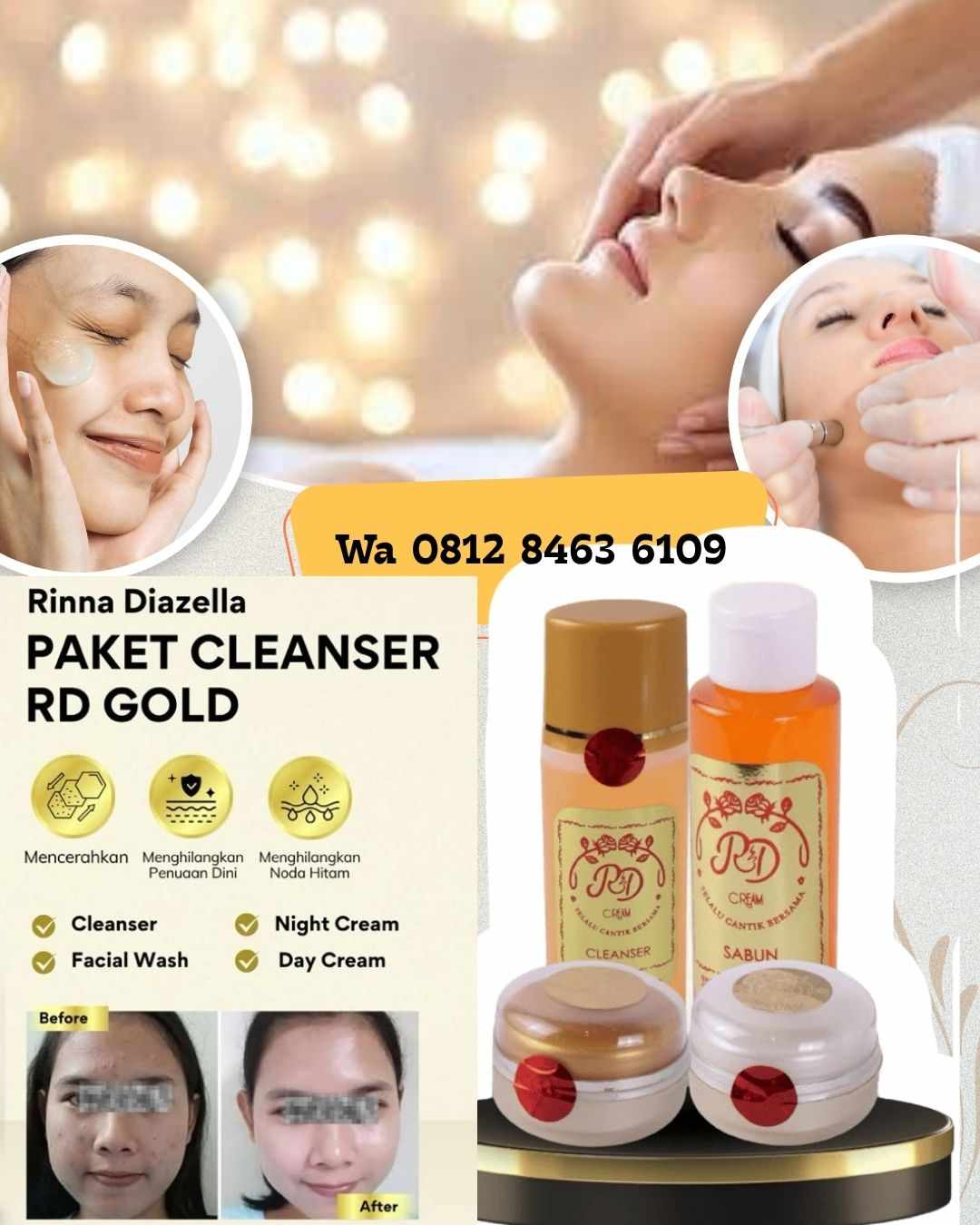 paket rd rinna diazella untuk bruntusan- o8i2-8463-6IO9, Sukabumi